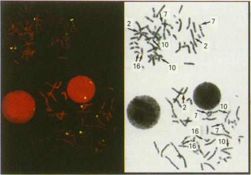 https://cdn.ncbi.nlm.nih.gov/pmc/blobs/1aee/2033297/8b91dbd5dc44/brjcancer00053-0089-a.jpg
