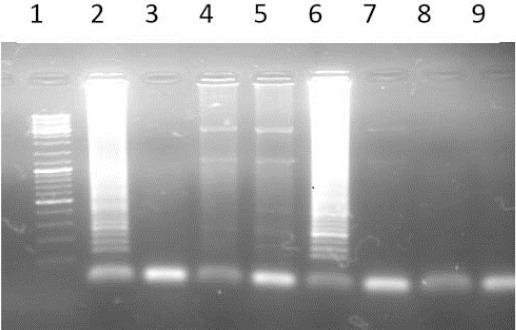 https://cdn.ncbi.nlm.nih.gov/pmc/blobs/1af2/6560289/967f1d6c2dfb/OAMJMS-7-1582-g005.jpg