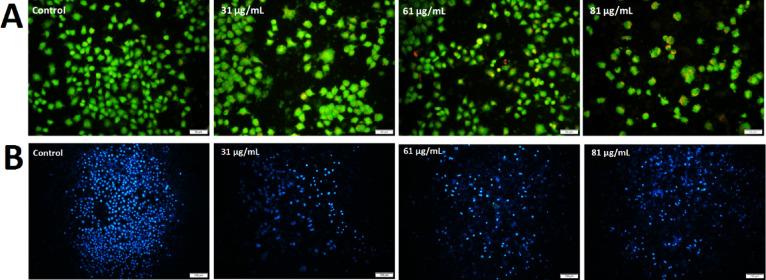 https://cdn.ncbi.nlm.nih.gov/pmc/blobs/1af3/12089437/62363f29bf24/41598_2025_2344_Fig6_HTML.jpg