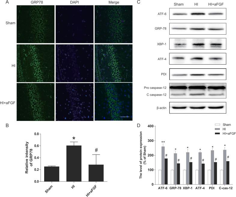 https://cdn.ncbi.nlm.nih.gov/pmc/blobs/1af7/5617396/94b5f04193d2/oncotarget-08-60941-g004.jpg