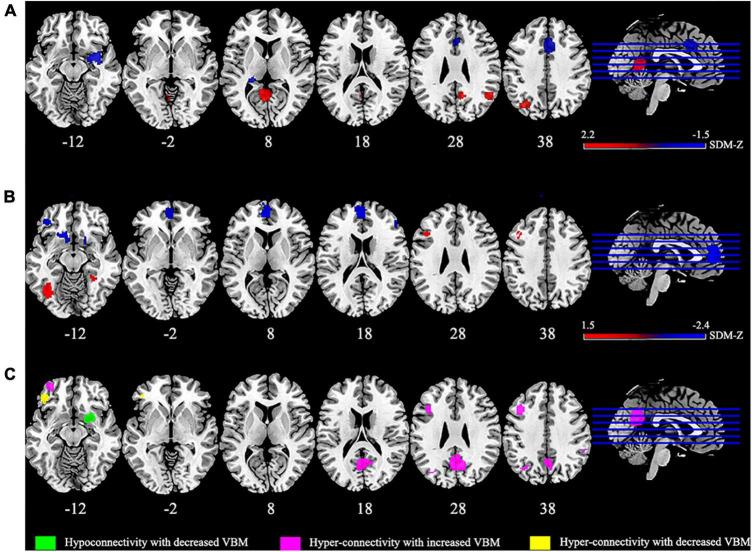 https://cdn.ncbi.nlm.nih.gov/pmc/blobs/1b00/10627928/3a91a7c132a3/fnins-17-1236069-g002.jpg