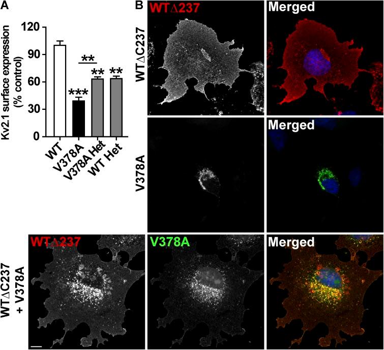 https://cdn.ncbi.nlm.nih.gov/pmc/blobs/1b03/4621747/5c1999e30daa/JGP_201511444_Fig5.jpg