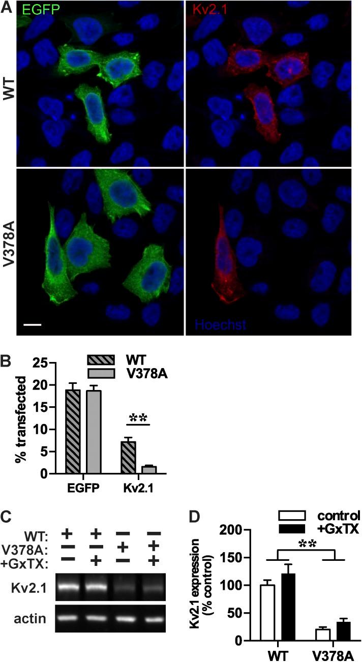 https://cdn.ncbi.nlm.nih.gov/pmc/blobs/1b03/4621747/c67eccc4b8d8/JGP_201511444_Fig3.jpg