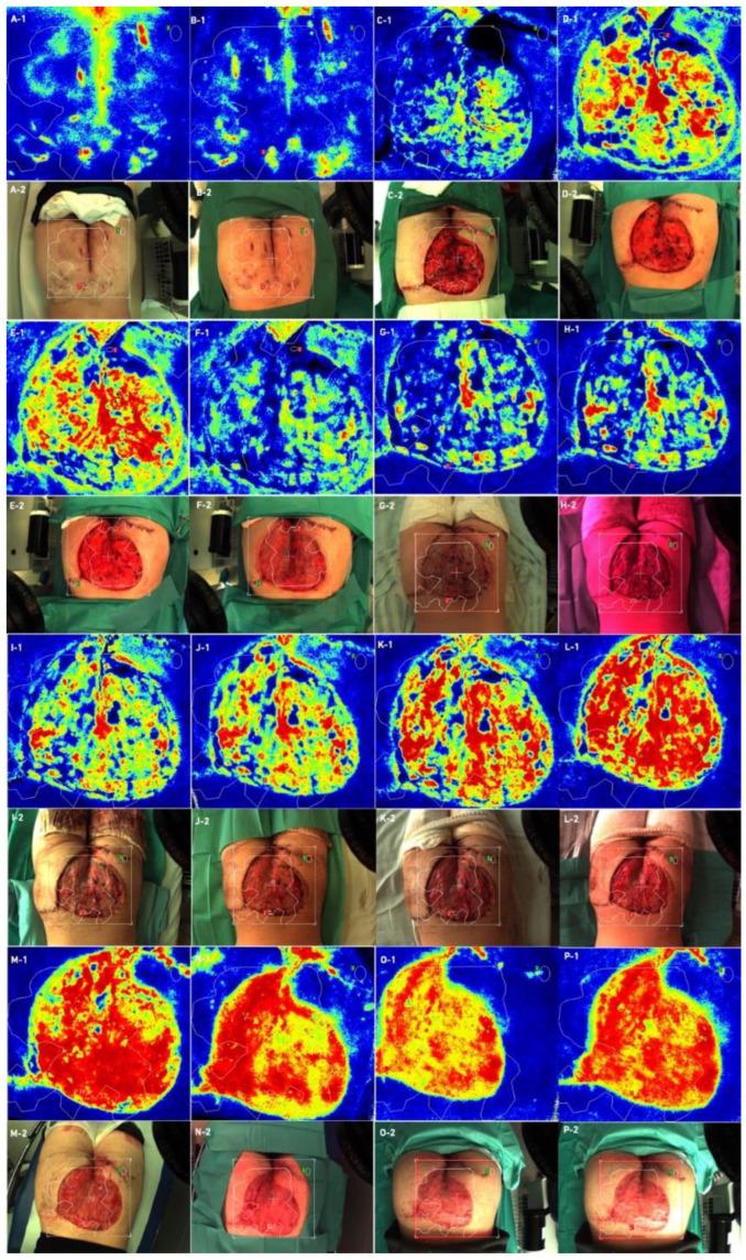 https://cdn.ncbi.nlm.nih.gov/pmc/blobs/1b03/9404734/587a36c62699/bioengineering-09-00389-g005.jpg