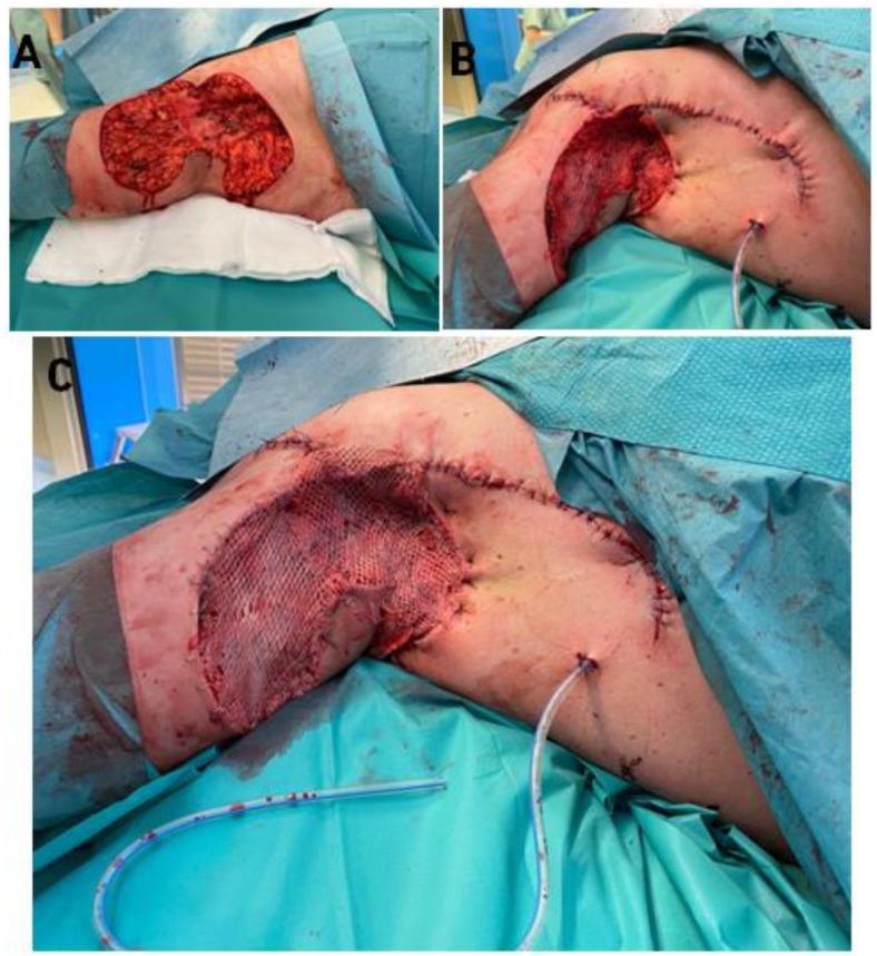 https://cdn.ncbi.nlm.nih.gov/pmc/blobs/1b03/9404734/7382b689c4d7/bioengineering-09-00389-g004.jpg
