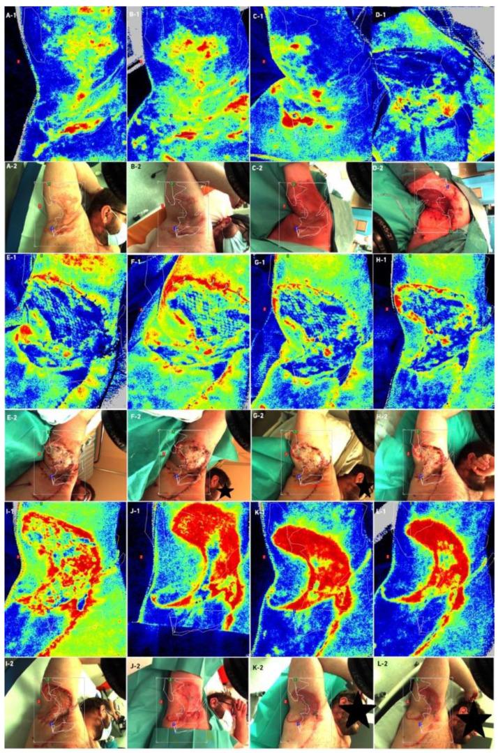 https://cdn.ncbi.nlm.nih.gov/pmc/blobs/1b03/9404734/98d4cb83ca4e/bioengineering-09-00389-g007.jpg