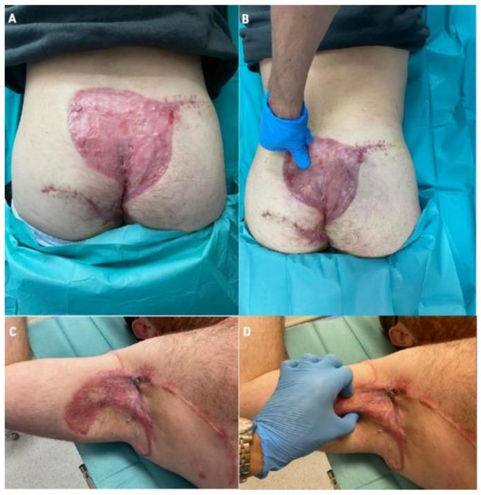 https://cdn.ncbi.nlm.nih.gov/pmc/blobs/1b03/9404734/b433086ef8db/bioengineering-09-00389-g009.jpg