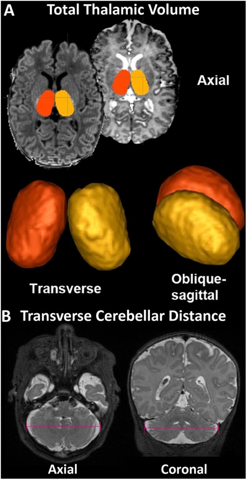 https://cdn.ncbi.nlm.nih.gov/pmc/blobs/1b0c/6145929/82e556a58bb8/41598_2018_32288_Fig2_HTML.jpg