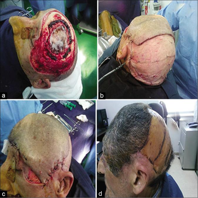 https://cdn.ncbi.nlm.nih.gov/pmc/blobs/1b0f/7656049/2af66caa7224/SNI-11-347-g003.jpg