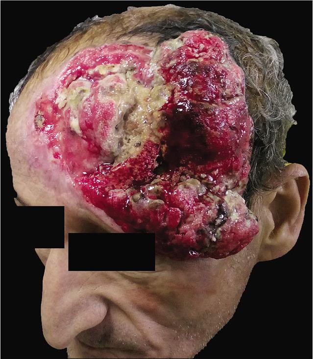 https://cdn.ncbi.nlm.nih.gov/pmc/blobs/1b0f/7656049/76ba8b6133d7/SNI-11-347-g001.jpg