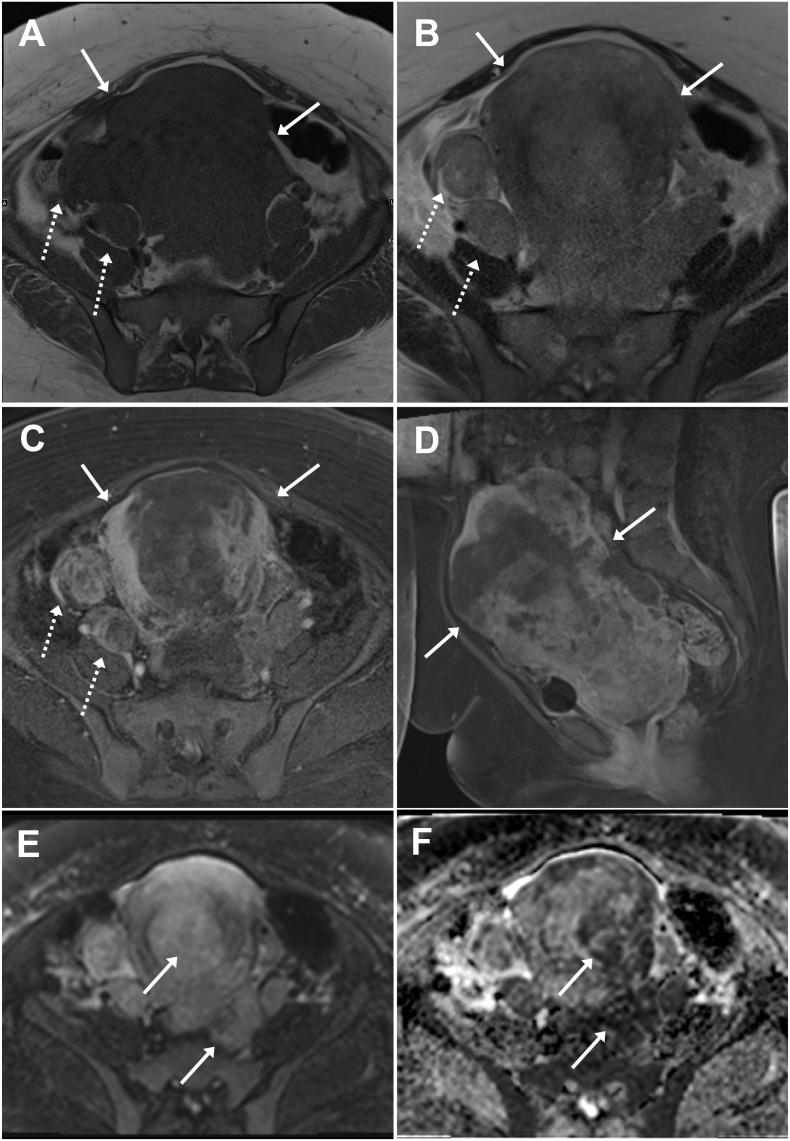 https://cdn.ncbi.nlm.nih.gov/pmc/blobs/1b12/7287265/3cb3b6baae85/gr2.jpg