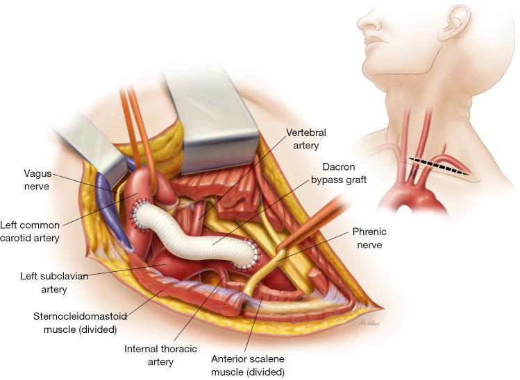 https://cdn.ncbi.nlm.nih.gov/pmc/blobs/1b16/10478019/5cb4890aad19/cdt-13-04-736-f2.jpg