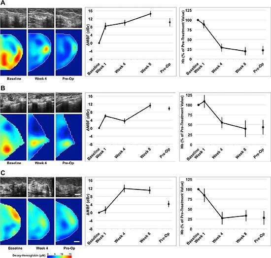 https://cdn.ncbi.nlm.nih.gov/pmc/blobs/1b18/4991417/738a28bab81f/oncotarget-07-19762-g002.jpg