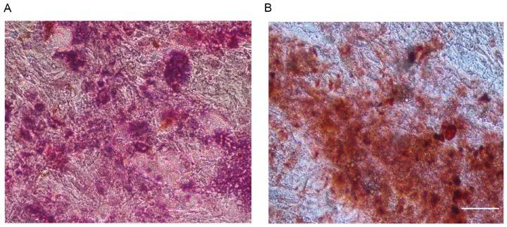 https://cdn.ncbi.nlm.nih.gov/pmc/blobs/1b1d/5547952/b7ac88ad843a/MMR-16-03-2497-g01.jpg