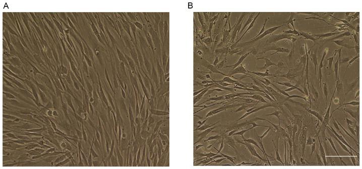 https://cdn.ncbi.nlm.nih.gov/pmc/blobs/1b1d/5547952/fdb2e8039904/MMR-16-03-2497-g00.jpg