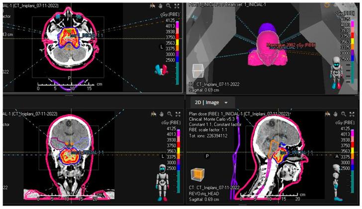 https://cdn.ncbi.nlm.nih.gov/pmc/blobs/1b26/10705113/f40323bbfa65/cancers-15-05579-g001.jpg