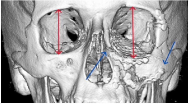 https://cdn.ncbi.nlm.nih.gov/pmc/blobs/1b2a/11995822/552f6952eb39/cmtr-18-00019-g001.jpg