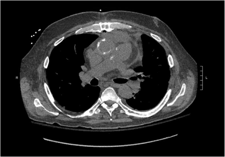 https://cdn.ncbi.nlm.nih.gov/pmc/blobs/1b3a/11999371/8921591cd014/gr1.jpg
