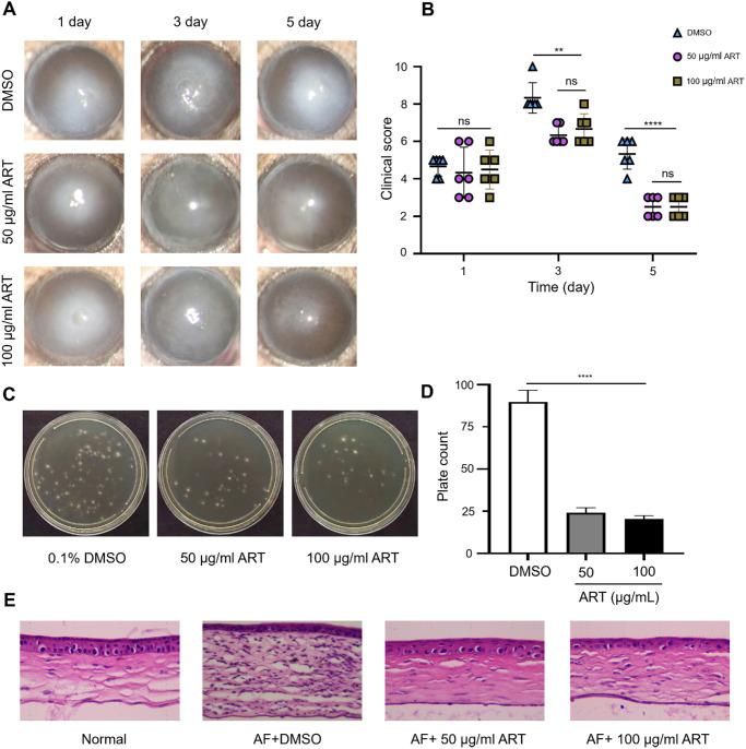 https://cdn.ncbi.nlm.nih.gov/pmc/blobs/1b40/12347252/5413a40b7439/iovs-66-11-19-f003.jpg