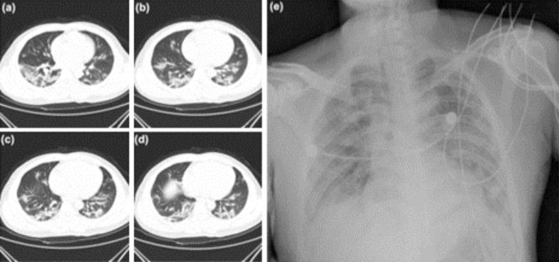 https://cdn.ncbi.nlm.nih.gov/pmc/blobs/1b41/9833856/6155fa71843b/gr7_lrg.jpg