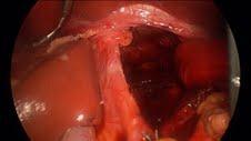 https://cdn.ncbi.nlm.nih.gov/pmc/blobs/1b43/3459700/63ea5223e01c/1752-1947-6-234-3.jpg