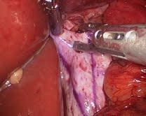 https://cdn.ncbi.nlm.nih.gov/pmc/blobs/1b43/3459700/b8387db42764/1752-1947-6-234-7.jpg