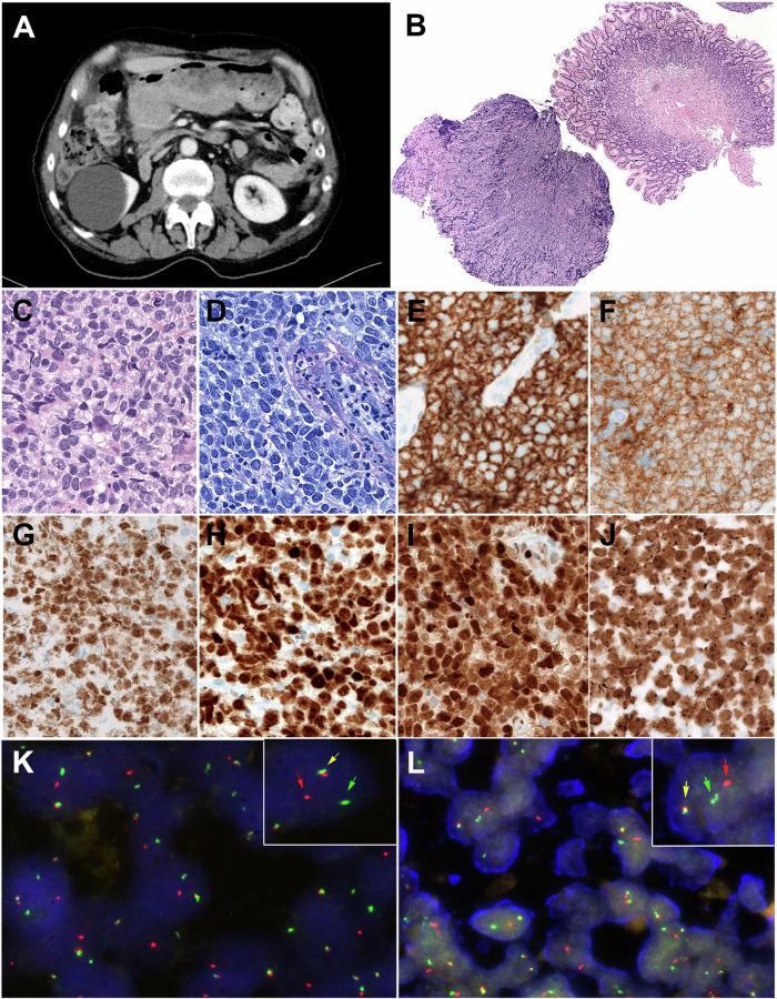 https://cdn.ncbi.nlm.nih.gov/pmc/blobs/1b4d/11420347/3f40f530194b/41408_2024_1146_Fig5_HTML.jpg