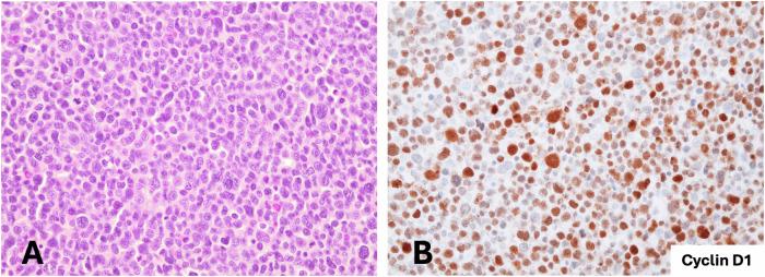 https://cdn.ncbi.nlm.nih.gov/pmc/blobs/1b4d/11420347/ae695b5c5fec/41408_2024_1146_Fig3_HTML.jpg