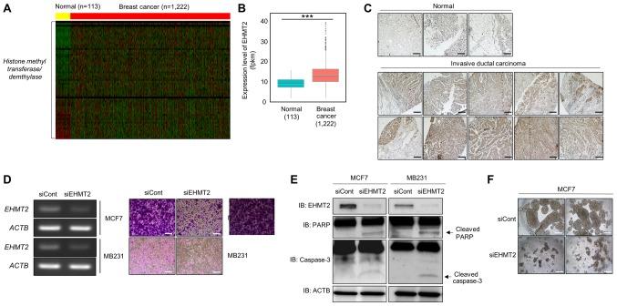 https://cdn.ncbi.nlm.nih.gov/pmc/blobs/1b4d/6254934/c75c3c72c87b/IJO-54-01-0065-g00.jpg