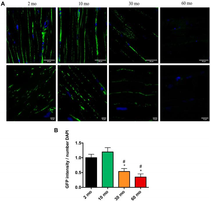 https://cdn.ncbi.nlm.nih.gov/pmc/blobs/1b52/11172448/27c118048b85/ijms-25-06166-g006.jpg