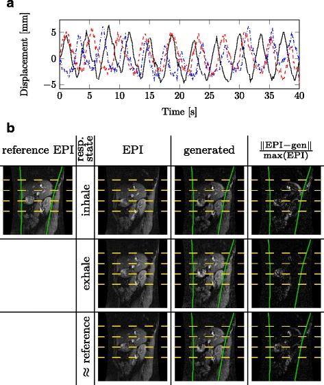 https://cdn.ncbi.nlm.nih.gov/pmc/blobs/1b52/5523151/1310c12ba6b8/40349_2017_98_Fig4_HTML.jpg