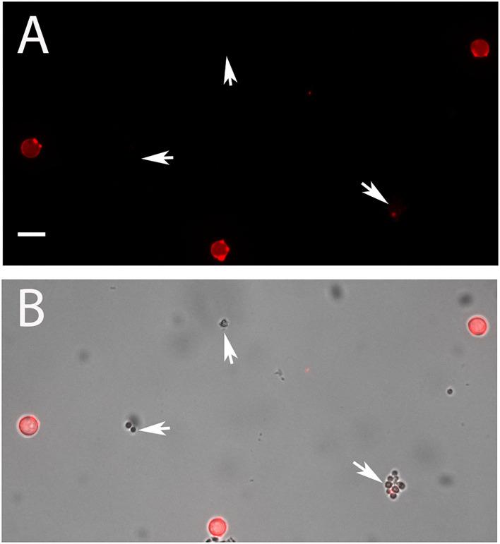 https://cdn.ncbi.nlm.nih.gov/pmc/blobs/1b54/9245049/e2ca62728ac8/fmicb-13-896145-g0003.jpg