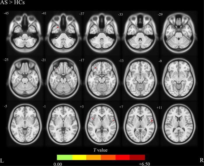 https://cdn.ncbi.nlm.nih.gov/pmc/blobs/1b59/9381807/b80c79d93bc3/fnins-16-961489-g001.jpg