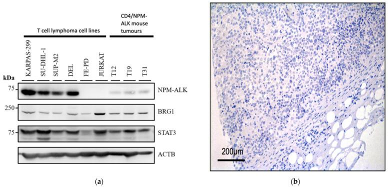 https://cdn.ncbi.nlm.nih.gov/pmc/blobs/1b5f/8750310/4cf0ae3869df/cancers-14-00151-g001a.jpg