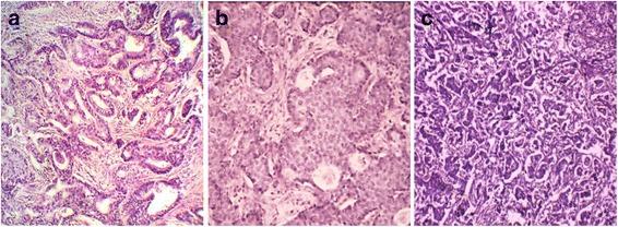 https://cdn.ncbi.nlm.nih.gov/pmc/blobs/1b60/5704424/53b7221ab063/12995_2017_178_Fig1_HTML.jpg