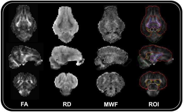 https://cdn.ncbi.nlm.nih.gov/pmc/blobs/1b64/12127305/13fba269069d/fnins-19-1576274-g0001.jpg