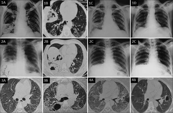 https://cdn.ncbi.nlm.nih.gov/pmc/blobs/1b67/10959308/f04610c2d346/LI-41-103-g002.jpg