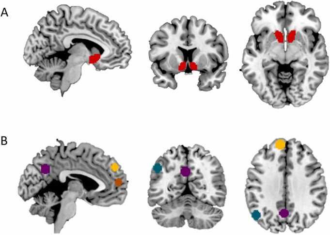 https://cdn.ncbi.nlm.nih.gov/pmc/blobs/1b68/11743848/441c8a0057a3/gr2.jpg
