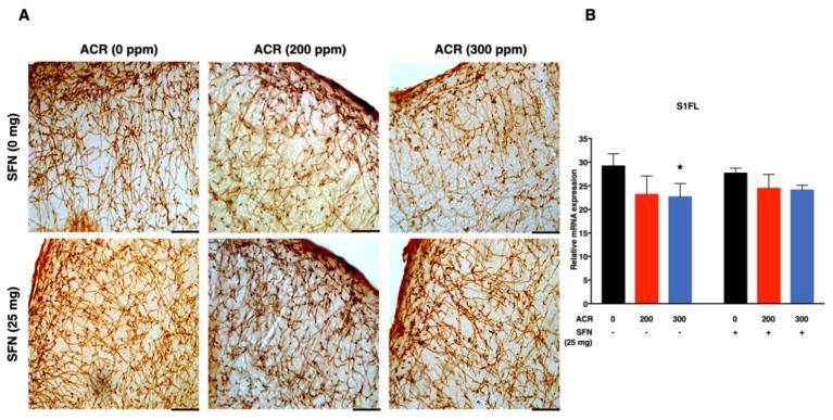 https://cdn.ncbi.nlm.nih.gov/pmc/blobs/1b68/8199319/295ddd0f987d/ijms-22-05995-g004.jpg