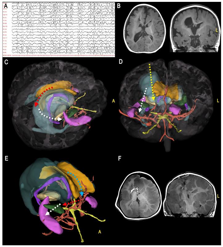 https://cdn.ncbi.nlm.nih.gov/pmc/blobs/1b6e/10253562/0449101a160b/jcm-12-03779-g005.jpg