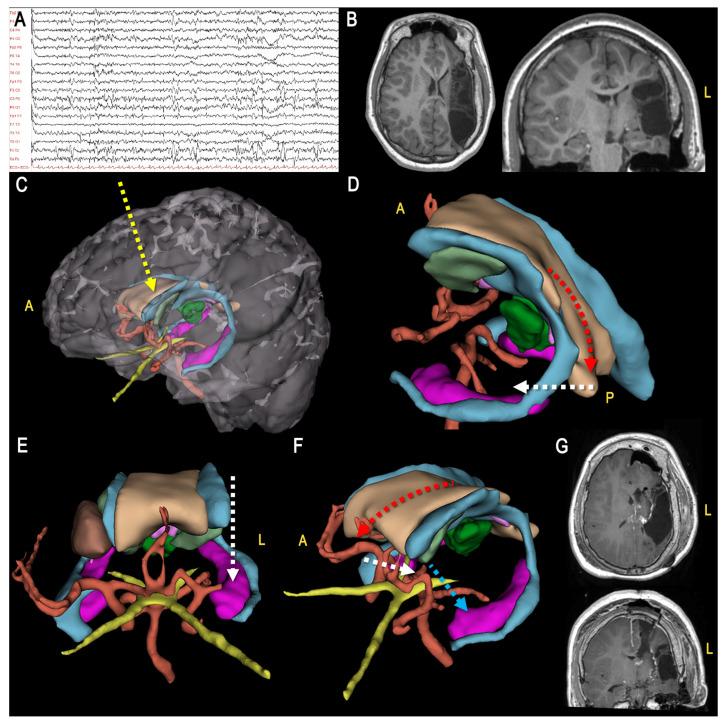 https://cdn.ncbi.nlm.nih.gov/pmc/blobs/1b6e/10253562/225e57e7e77f/jcm-12-03779-g006.jpg