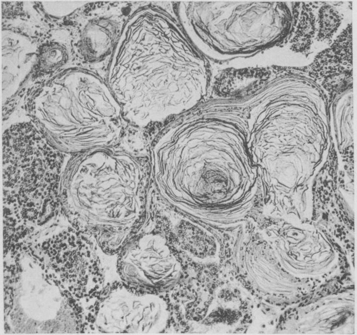 https://cdn.ncbi.nlm.nih.gov/pmc/blobs/1b75/2099039/aec73f29e392/jmedres00078-0209-a.jpg