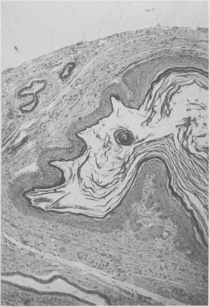 https://cdn.ncbi.nlm.nih.gov/pmc/blobs/1b75/2099039/c73b695ded0c/jmedres00078-0204-b.jpg