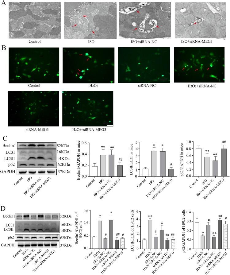 https://cdn.ncbi.nlm.nih.gov/pmc/blobs/1b76/10286679/e11a6c40b4f0/YRER_A_2224607_F0004_OC.jpg