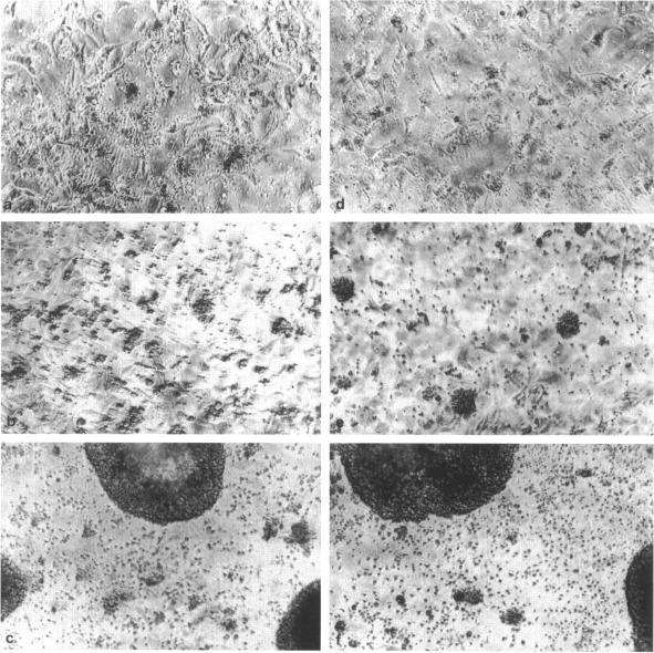 https://cdn.ncbi.nlm.nih.gov/pmc/blobs/1b79/1858212/79ecc2abf398/amjpathol00029-0084-a.jpg