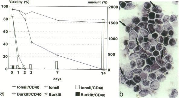https://cdn.ncbi.nlm.nih.gov/pmc/blobs/1b79/1858212/91fd3e3d33c5/amjpathol00029-0085-b.jpg