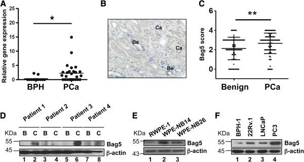 https://cdn.ncbi.nlm.nih.gov/pmc/blobs/1b7a/3598994/cd1f08e2d9a6/1471-2407-13-96-1.jpg