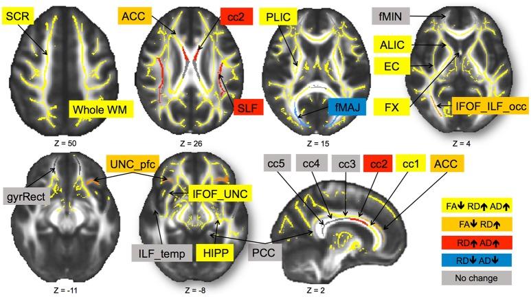 https://cdn.ncbi.nlm.nih.gov/pmc/blobs/1b7e/5352690/43329ec080ae/fnagi-09-00059-g0001.jpg