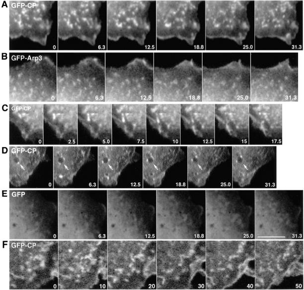https://cdn.ncbi.nlm.nih.gov/pmc/blobs/1b84/2175235/939c6dcb8dd1/JCB9805067.f1.jpg