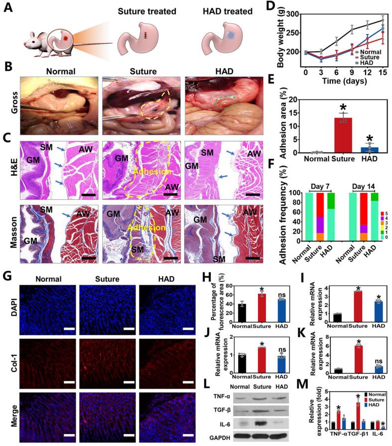https://cdn.ncbi.nlm.nih.gov/pmc/blobs/1b8e/10614681/dc8a315b5d9f/thnov13p5365g004.jpg